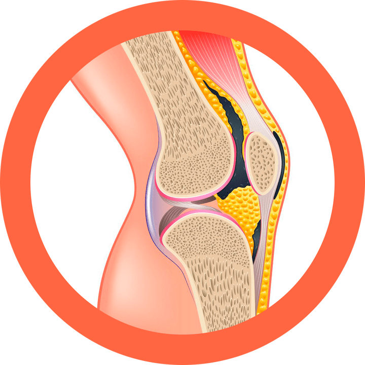 Hondroten - artikulazioak eta muskuluak leheneratzen ditu