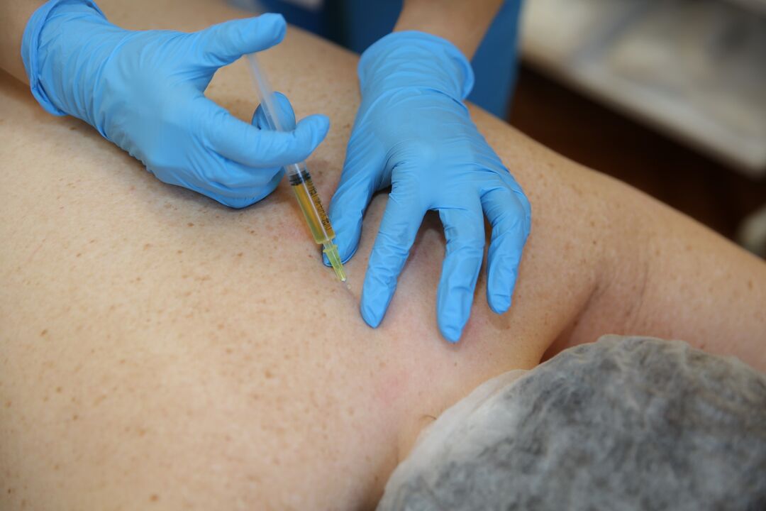 bizkarrerako chondroprotectors injekzioak