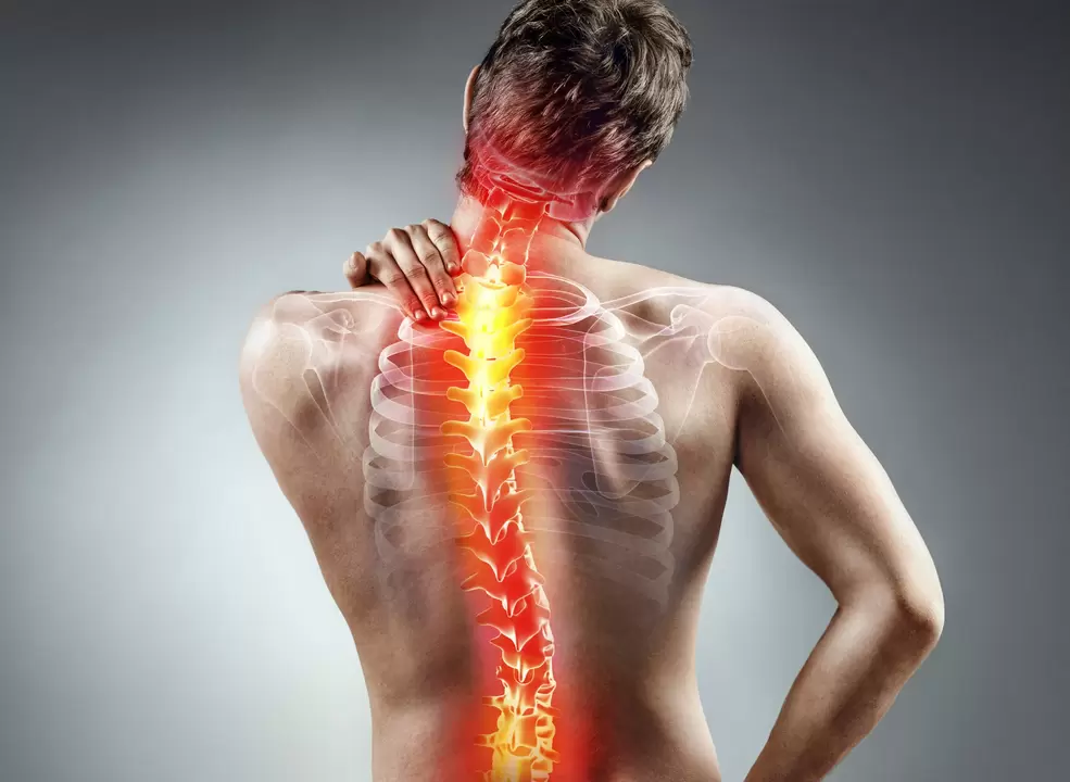 bizkarrezurreko osteokondrosia